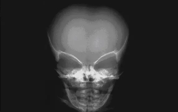 The Visitor 2 - Mga piktur